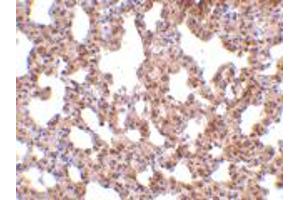 Immunohistochemistry of TRPC6 in mouse lung tissue with TRPC6 polyclonal antibody  at 10 ug/mL . (TRPC6 anticorps  (C-Term))