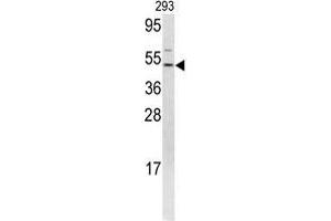 Western blot analysis of FLI1 antibody (N-term) in 293 cell line lysates (35 µg/lane). (FLI1 anticorps  (N-Term))
