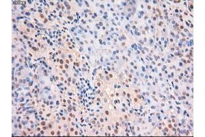 Image no. 8 for anti-Myc Proto-Oncogene protein (MYC) antibody (ABIN1497013) (c-MYC anticorps)