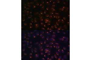 Immunofluorescence analysis of U-2 OS cells using G antibody (ABIN6133219, ABIN6140940, ABIN6140941 and ABIN6222644) at dilution of 1:100.