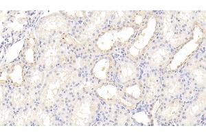 Detection of TIMP3 in Human Kidney Tissue using Polyclonal Antibody to Tissue Inhibitors Of Metalloproteinase 3 (TIMP3) (TIMP3 anticorps  (AA 26-211))