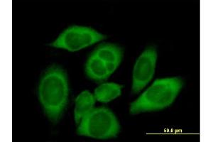 Immunofluorescence of purified MaxPab antibody to CARS on HeLa cell. (CARS anticorps  (AA 1-748))