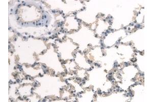Detection of ARNTL in Rat Lung Tissue using Polyclonal Antibody to Aryl Hydrocarbon Receptor Nuclear Translocator Like Protein (ARNTL)