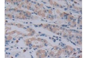 Detection of ChAT in Human Stomach Tissue using Polyclonal Antibody to Choline Acetyltransferase (ChAT)