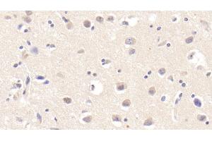 Detection of Tie1 in Human Cerebrum Tissue using Polyclonal Antibody to Tyrosine Kinase With Immunoglobulin Like And EGF Like Domains Protein 1 (Tie1)