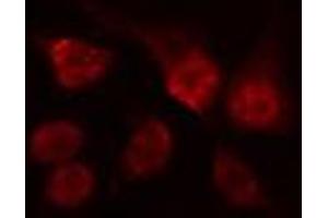 ABIN6274517 staining Hela cells by IF/ICC. (ARNT2 anticorps  (N-Term))