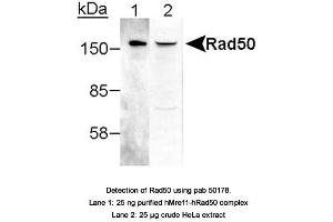 Image no. 1 for anti-RAD50 Homolog (S. Cerevisiae) (RAD50) antibody (ABIN363487) (RAD50 anticorps)