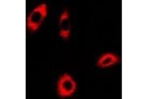 Immunofluorescent analysis of PHACS staining in A549 cells.