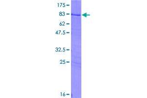 Image no. 1 for Synovial Sarcoma Translocation, Chromosome 18 (SS18) (AA 1-418) protein (GST tag) (ABIN1321375)