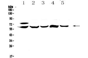 Western blot analysis of CES1 using anti-CES1 antibody . (CES1 anticorps  (AA 99-206))