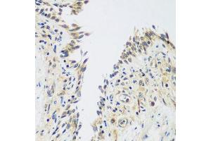 Immunohistochemistry of paraffin-embedded human lung using UPF2 antibody.