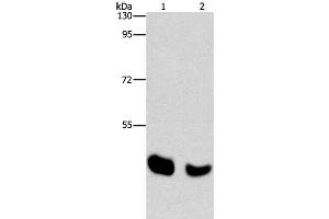 Western Blot analysis of Human normal liver and Mouse pancreas tissue using BAAT Polyclonal Antibody at dilution of 1:650 (BAAT anticorps)