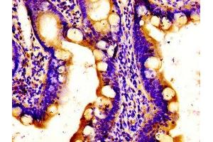 Immunohistochemistry of paraffin-embedded human small intestine tissue using ABIN7150152 at dilution of 1:100 (APOBEC3D anticorps  (AA 250-371))