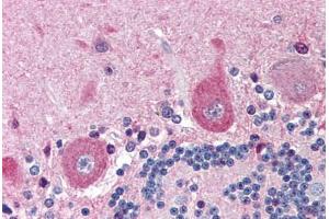 Human Brain, Cerebellum (formalin-fixed, paraffin-embedded) stained with NGFR antibody ABIN214454 at 5 ug/ml followed by biotinylated goat anti-rabbit IgG secondary antibody ABIN481713, alkaline phosphatase-streptavidin and chromogen. (NGFR anticorps)