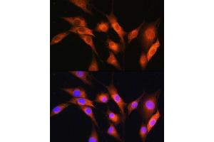 Immunofluorescence analysis of NIH/3T3 cells using  Rabbit pAb (ABIN7265658) at dilution of 1:100.