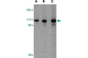Western blot analysis of IFIH1 in Daudi cell lysate with IFIH1 polyclonal antibody  at (A) 1, (B) 2 and (C) 4 ug/mL . (IFIH1 anticorps  (C-Term))