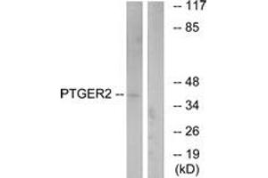 Western blot analysis of extracts from HeLa cells, using PTGER2 Antibody. (PTGER2 anticorps  (AA 260-309))