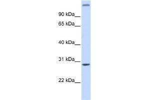 WB Suggested Anti-ALKBH2 Antibody Titration: 0. (ALKBH2 anticorps  (Middle Region))