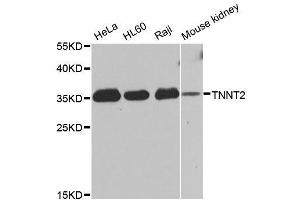 Western blot analysis of extracts of various cell lines, using TNNT2 antibody. (Cardiac Troponin T2 anticorps  (AA 1-120))