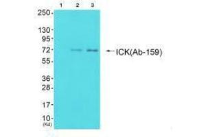 Western blot analysis of extracts from 293 cells (Lane 2) and cos-7 cells (Lane 3), using ICK (Ab-159) antiobdy. (ICK anticorps  (Tyr159))