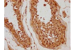 IHC image of ABIN7175810 diluted at 1:500 and staining in paraffin-embedded human testis tissue performed on a Leica BondTM system. (WDR92 anticorps  (AA 122-357))