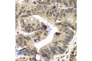 Immunohistochemistry of paraffin-embedded human colon using UFD1L antibody (ABIN6291036) at dilution of 1:100 (40x lens).