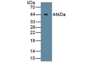 Detection of Recombinant C9, Rabbit using Polyclonal Antibody to Complement Component 9 (C9) (C9 anticorps  (AA 139-519))