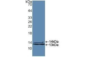 Detection of Recombinant HNRPA2B1, Human using Polyclonal Antibody to Heterogeneous Nuclear Ribonucleoprotein A2/B1 (HNRPA2B1) (HNRNPA2B1 anticorps  (AA 21-103))