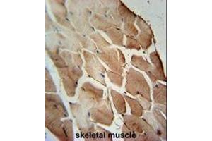 ACOT11 Antibody (C-term) immunohistochemistry analysis in formalin fixed and paraffin embedded human skeletal muscle followed by peroxidase conjugation of the secondary antibody and DAB staining.