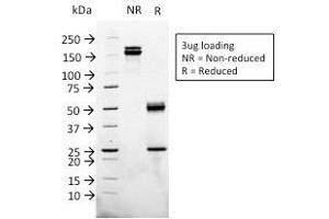 SDS-PAGE of Purified Glypican-3 Monoclonal Antibody (1G12). (Glypican 3 anticorps  (AA 511-580))