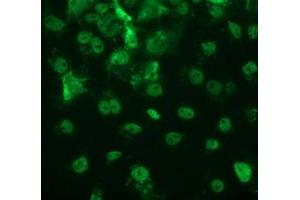 Anti-TP53 mouse monoclonal antibody (ABIN2454486) immunofluorescent staining of COS7 cells transiently transfected by pCMV6-ENTRY TP53 (RC200003). (p53 anticorps)