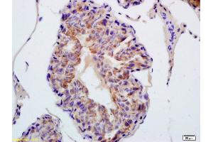 Formalin-fixed and paraffin embedded rat testis labeled with Anti-TXNRD1 Polyclonal Antibody, Unconjugated (ABIN1386102) at 1:200 followed by conjugation to the secondary antibody and DAB staining (TXNRD1 anticorps  (AA 451-550))