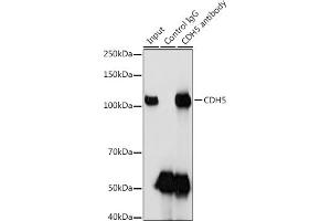 Immunoprecipitation analysis of 600 μg extracts of Mouse lung using 3 μg CDH5 antibody (ABIN6134029, ABIN6138297, ABIN6138298 and ABIN6216033).
