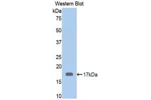 Detection of Recombinant CALR, Human using Polyclonal Antibody to Calreticulin (CALR) (Calreticulin anticorps  (AA 196-310))