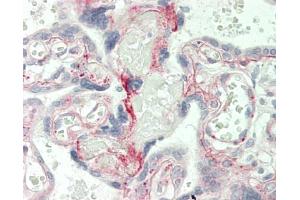 Human Placenta: Formalin-Fixed, Paraffin-Embedded (FFPE) (Laminin gamma 1 anticorps)