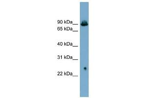 SLC6A5 antibody used at 1 ug/ml to detect target protein. (SLC6A5 anticorps)