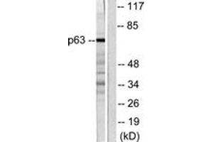 Western blot analysis of extracts from COS7 cells, using p63 Antibody. (TCP1 alpha/CCTA anticorps  (AA 631-680))