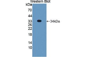 Detection of Recombinant STX2, Human using Polyclonal Antibody to Syntaxin 2 (STX2) (STX2 anticorps  (AA 8-262))