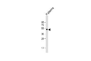Anti-PROC Antibody at 1:1000 dilution + H. (PROC anticorps)