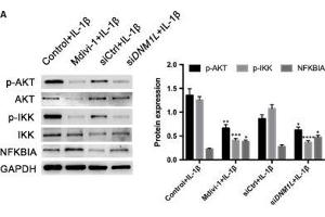 DNM1L deficiency attenuates the IL-1β-induced NF-κB activation in FLSs.