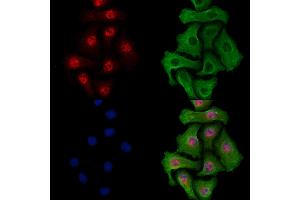 anti-Cancer Susceptibility Candidate 5 (CASC5) antibody