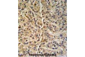 Immunohistochemistry (IHC) image for anti-Glucosamine (N-Acetyl)-6-Sulfatase (GNS) antibody (ABIN3002692)