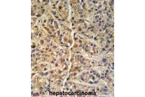 Immunohistochemistry (IHC) image for anti-Glucosamine (N-Acetyl)-6-Sulfatase (GNS) antibody (ABIN3002692) (GNS anticorps)