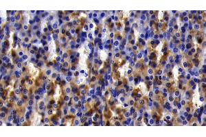 Detection of IkBa in Rat Stomach Tissue using Polyclonal Antibody to Inhibitory Subunit Of NF Kappa B Alpha (IkBa)
