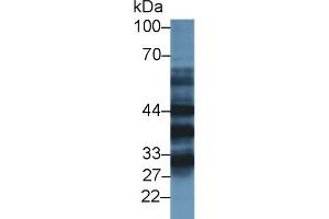 Detection of TMOD3 in Mouse Lung lysate using Polyclonal Antibody to Tropomodulin 3 (TMOD3)
