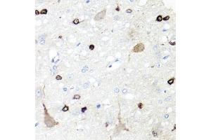 Immunohistochemistry of paraffin-embedded rat brain using IGFBP5 antibody. (IGFBP5 anticorps)