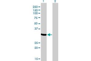 Western Blot analysis of ZNF215 expression in transfected 293T cell line by ZNF215 monoclonal antibody (M01), clone 2C11. (ZNF215 anticorps  (AA 1-304))