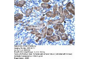 Human kidney (TRIM31 anticorps  (N-Term))