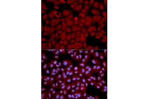 Immunofluorescence analysis of U2OS cells using PPP1CB antibody (ABIN5970446). (PPP1CB anticorps)