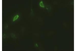 Anti-EpCAM mouse monoclonal antibody (ABIN2452362) immunofluorescent staining of HeLa cells transiently transfected by pCMV6-ENTRY EpCAM (RC201989) (EpCAM anticorps  (AA 24-265))